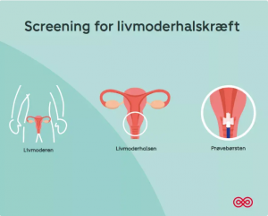 Screening-for-livmoderhalskrft
